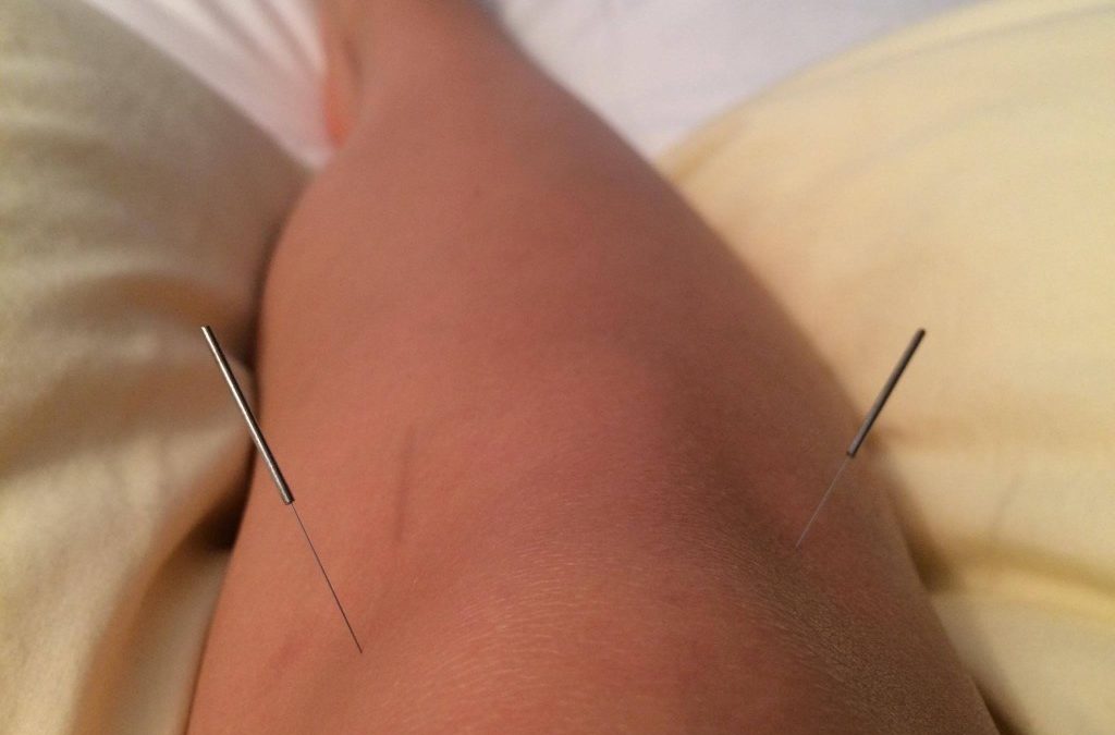 Community Acupuncture Clinic