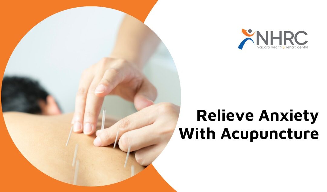 Relieve Anxiety With Acupuncture